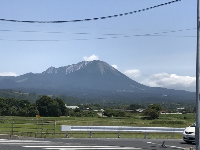 「歯の白い詰め物」