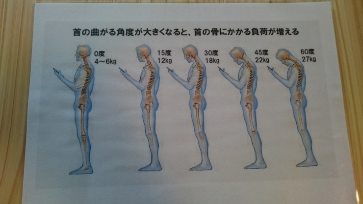 「スマホネック⁉  ストレートネック⁉」