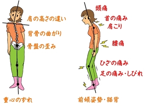 「姿勢の歪み・・・総合整体院カワカミ・寝屋川・萱島・守口・門真・健康の基本は足元から」