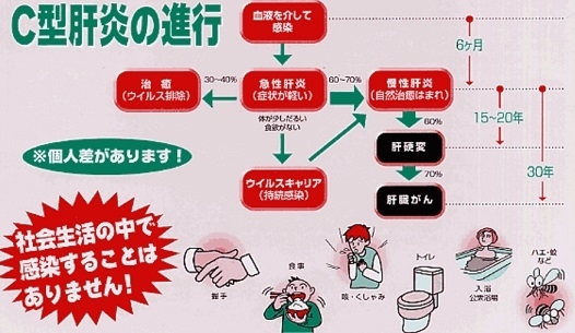 「肝炎ウイルス検診クーポン券を送付」