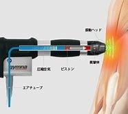 「ショックマスターの施術案内」