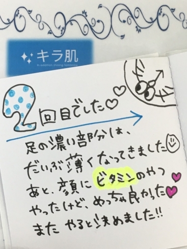 松江20代S.A様,全身脱毛vioお顔２回目口コミ「松江在住/20代「口コミ」全身脱毛vioお顔２回目。またやると決めました。」