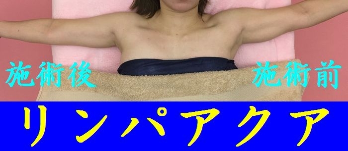 「二の腕ダイエット」