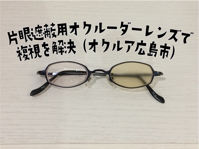 「片眼遮蔽用オクルーダーレンズで複視を解決（オクルア広島市）」