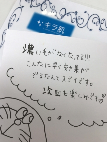 松江市矢田町在住A様4回目全身脱毛口コミ。「キラ肌：松江市20代A様。全身脱毛vio/顔4回目のお声」