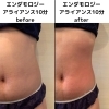ダイエット　トレーニング　痩身　セルフ　エステ じぶんdeエステ 有楽町マルイ店｜ホットペッパービューティー