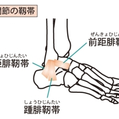 捻挫とは