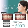 セルフホワイトニング初回500円キャンペーン✨ | フィットネスジムmore