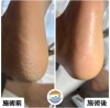 【anchan】かかと角質ケア ×47本 0070-2248_rt.jpg