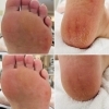 ネイルサロン使用　足角質ケア　プロヒール NEWプロヒール(NPHE)｜BEAUTY NAILER