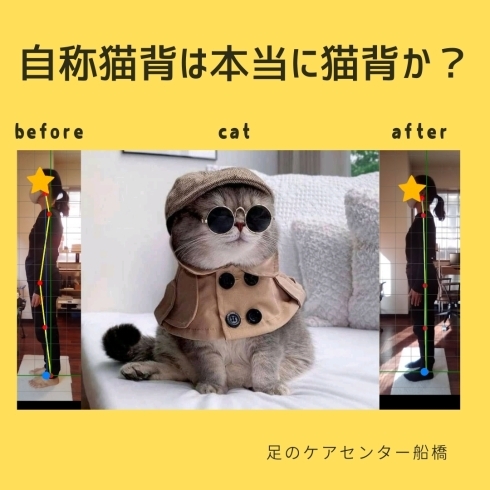 自称猫背は本当に猫背か「自称猫背は本当に猫背か【外反母趾.足育をはじめとした足の悩みの整体院　西船橋１分】」