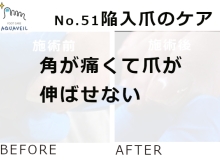 No.51陥入爪「角が痛くて爪が伸ばせない」