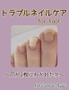 足爪のトラブル】爪が2枚ある⁈ | Foot Care & Lab. Bipedalのニュース