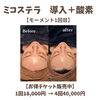 美容以上医療未満のミコステラ エアインジェクション！ 【出雲市