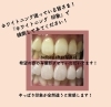 ホワイトニング 印象」で検索！ | WHITENING CARE（ホワイトニングケア）のニュース | まいぷれ[新居浜市]