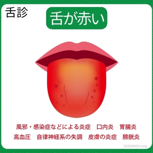 「舌診：舌が赤い」