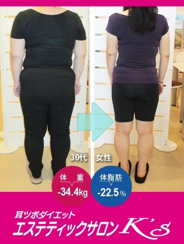 耳つぼダイエット ビフォーアフター写真「人生が変わった！100kg近い体重から－30kg以上の減量に成功！」