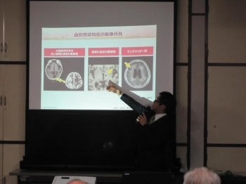 アルツハイマー型認知症の診断、<br>血管性認知症について講義する<br>佐藤科長