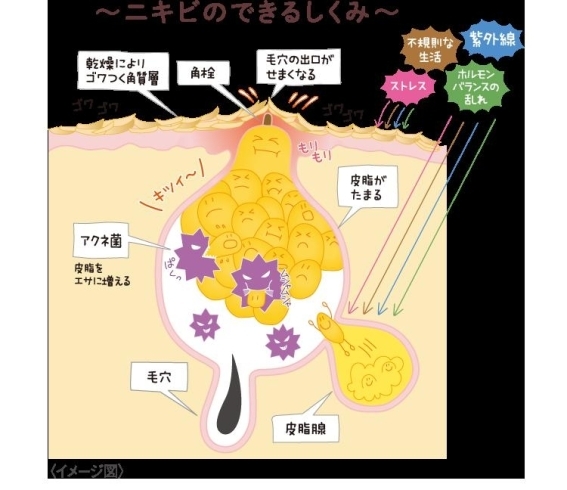 毛穴のつまり「「乾燥肌！大人のニキビでお悩みのあなた！毛穴の大掃除ですよ！！黒部 山内美容室 40代からきれいをみつけるお店」