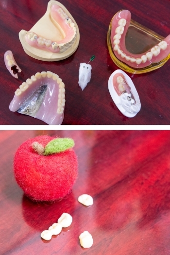 様々なサンプルを用いて丁寧な説明を心掛けています「アップル歯科」