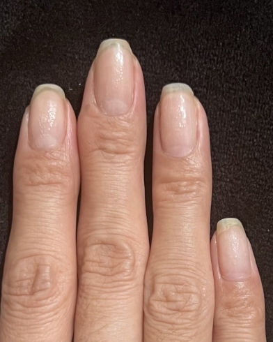 健康的な爪・指先へ✨「長年…悩んでいた爪も改善 🌺三郷市ネイルサロン🌺」