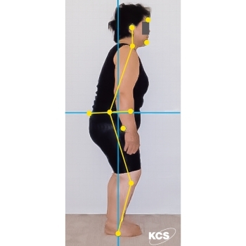姿勢プリントの結果をもとに、痛みの根源へダイレクトアプローチ「姿勢専科KCSセンター島根医科大前」