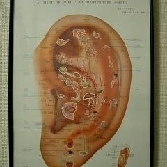 耳ツボ　（注.　耳ツボ健康ダイエットは有料です）