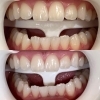 before after「【症例写真】歯が白くなると、表情まで明るく変わります！」