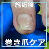 二枚爪からの補正　No.88-5「二枚爪からの補正　No.88」