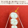 「デンタルフロスの豆知識4選✨　【南区澄川にある赤ちゃんから親子で通える歯科・歯医者さん桜田歯科医院】」