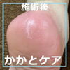 かかと集中ケア４「「夏のサンダル向け」かかと集中ケア　No.92 」