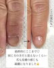 「別人級の変化【福井/自爪育成/ネイルサロン】」