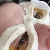 眼のエステ・ネトラバスティ