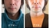 お客様のご主人様、年齢に相応しく若々しく(3回目)「能見台駅から徒歩2分Pearlbliss(ﾊﾟｰﾙﾌﾞﾘｽ)」