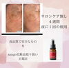 sangoステムレーションエッセンス「【松江/エステ】セラピスト歴20年以上のオーナーが思うこと【冷え/デトックス/エイジングケアはsalon.bless.k】」