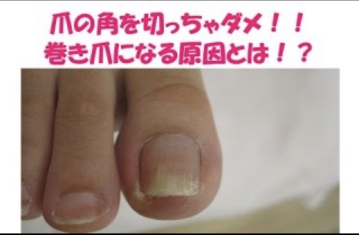 足の爪を切って貰ってる 情報発信スタイルcafe まるカフェのニュース まいぷれ 出雲 足の爪を切って貰ってる 情報発信スタイルcafe まるカフェのニュース まいぷれ 出雲