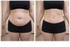 ルルオンで綺麗やせ「痩せたのに…老けた？それ本当に理想のダイエット？」