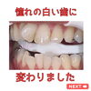 after「憧れで終わらせない！」