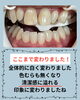 「口元の清潔感を高めたい方へ◎施術前後の変化を実感するメディカルホワイトニング」