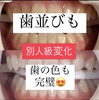 変わります「メディカルホワイトニング✨✨」
