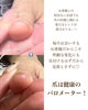 「急な爪のトラブルの原因【福井/自爪育成/ネイル】」