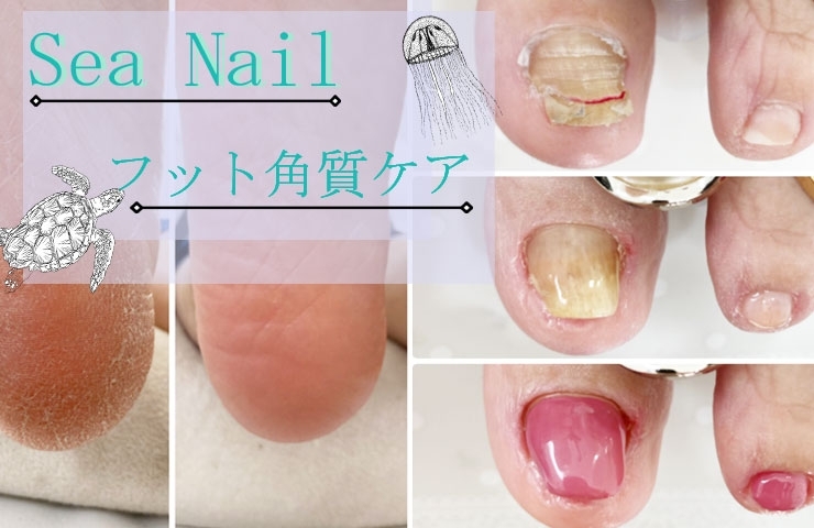 あかがねイチオシ 企画 Sea Nail シーネイル 新居浜あかがねポイント まいぷれ 新居浜市 あかがねイチオシ 企画 Sea Nail シーネイル 新居浜あかがねポイント まいぷれ 新居浜市