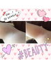 「人気の脱毛箇所は？？٩(๑❛ᴗ❛๑)۶」