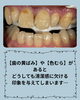 「口元の清潔感を高めたい方へ◎施術前後の変化を実感するメディカルホワイトニング」