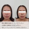 「このような方におすすめ！韓国トリプルハイフ【福井ハイフ/福井エステ/福井フェイシャルエステ/福井小顔】」