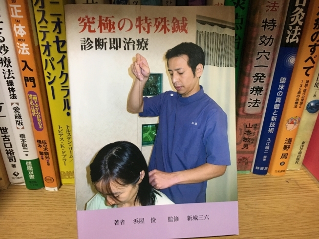 「究極の特殊鍼」