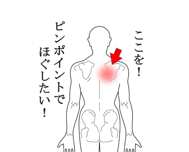 痛い 肩 甲骨 周り 肩の痛みの症例③：首を左に傾けると左肩に痛みが出るのが良くなった51歳女性の症例