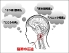 哲学、科学、芸術の集まった自然の法則に沿った治療法！上部頸椎