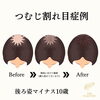 つむじの広がりが気になる方へ「分け目の透け感が気になる方へ：スカルプインク無料カウンセリングのご案内」