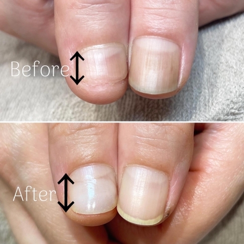 いまからでも遅くない 爪の噛み癖は治りますよ Nail By Kisimiiruのニュース まいぷれ 大阪市福島区 いまからでも遅くない 爪の噛み癖は治りますよ Nail By Kisimiiruのニュース まいぷれ 大阪市福島区